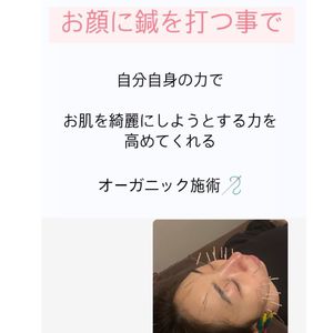 美容鍼を受けるとなぜ綺麗になれるの？  福山美容鍼　